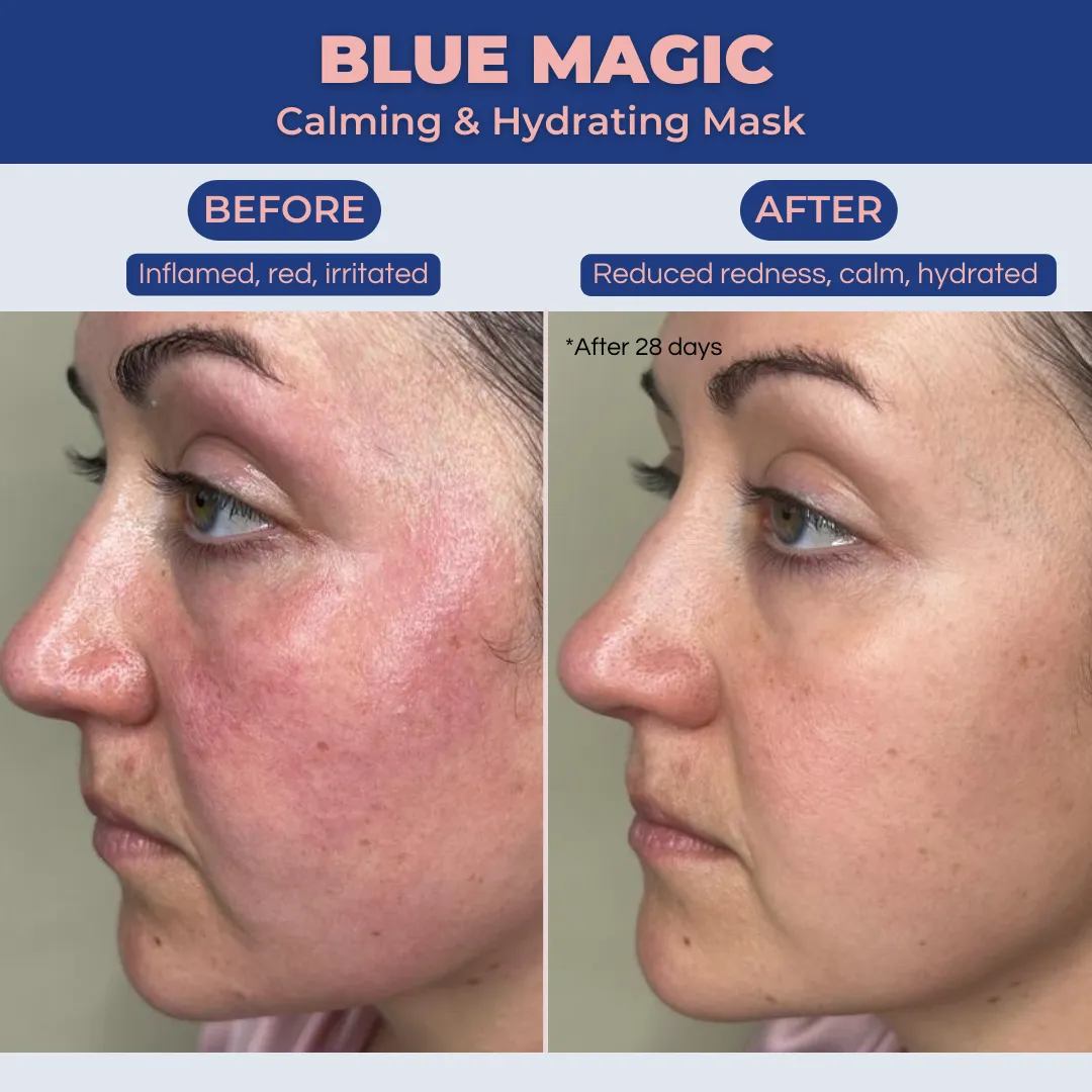 Blue Magic Mini