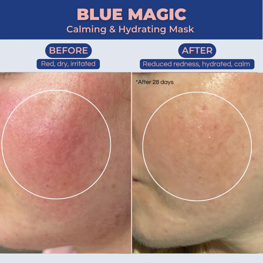 Blue Magic Mini